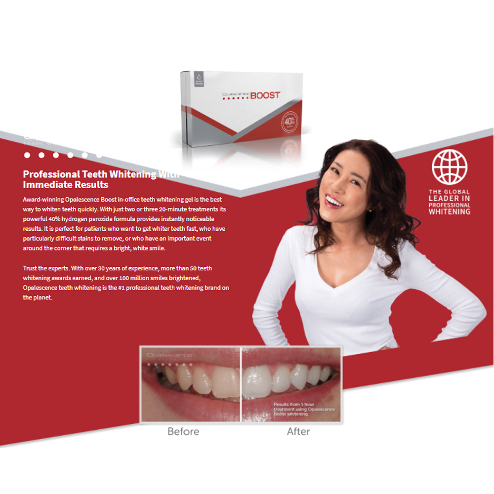 Teeth Whitening Gel Opalescence - Opalescence Boost 40% PF American Ultradent,