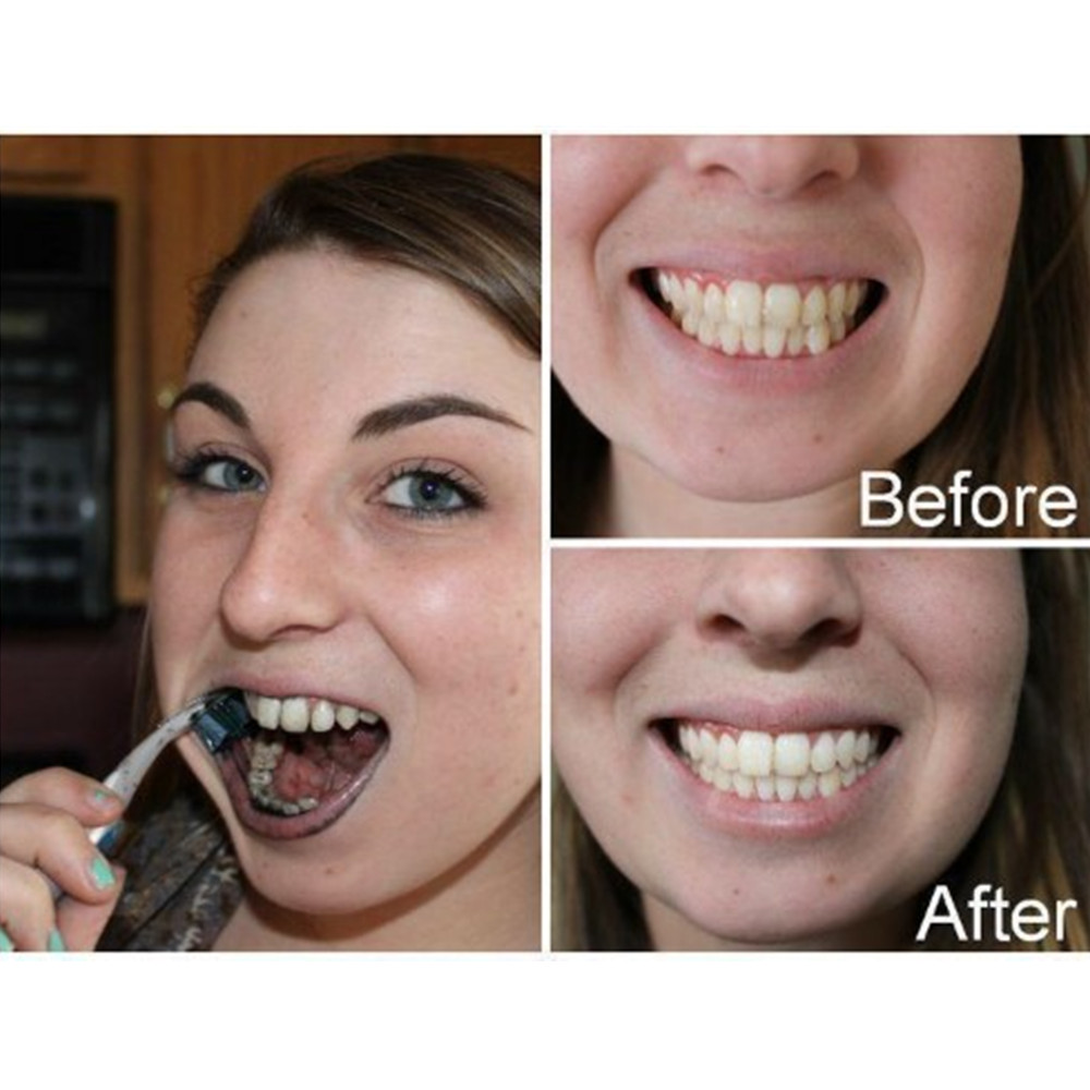 Dientes de carbón de bambú par - Teeth Whitening Charcoal Powder reseña y precio