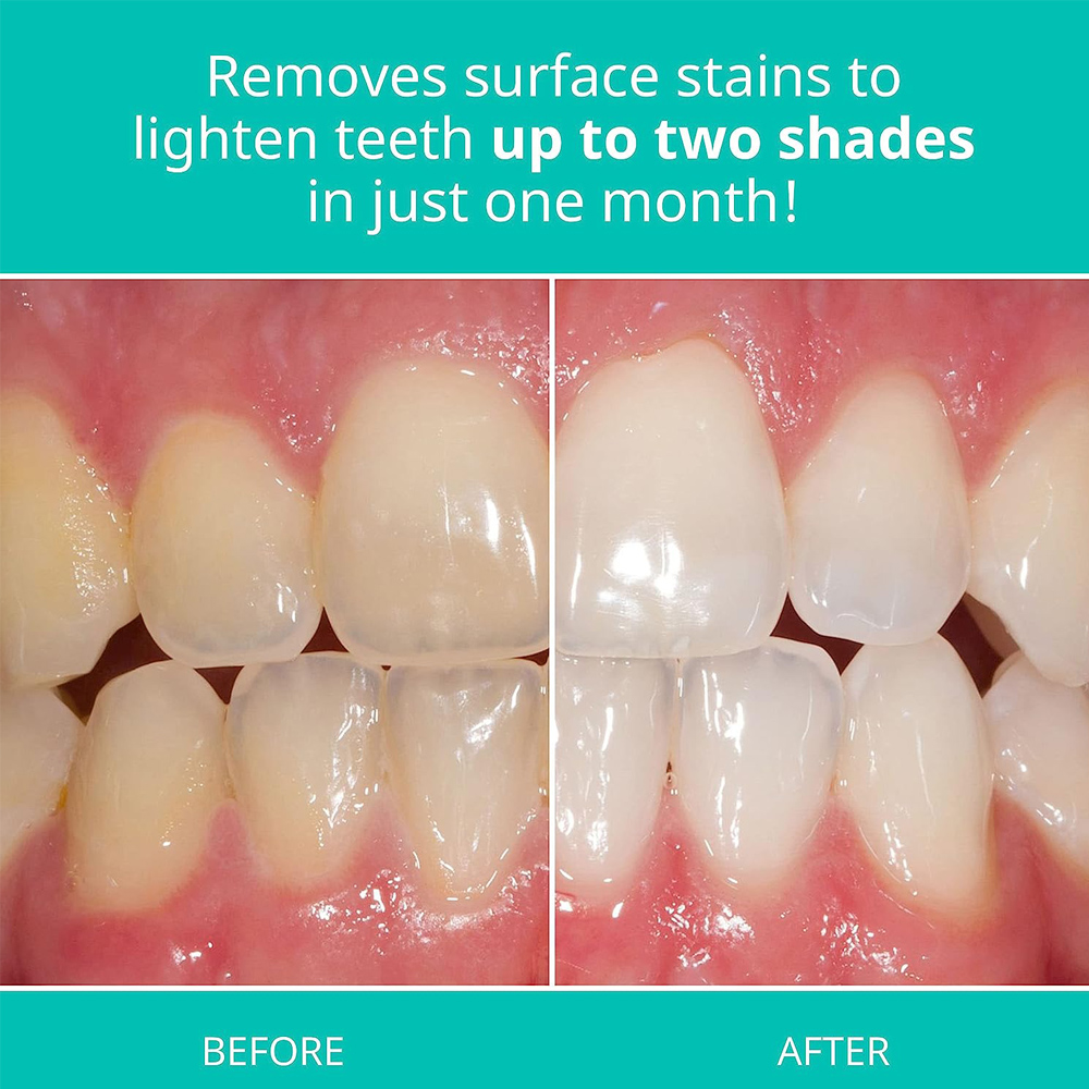 Pasta de dientes blanqueadora  - Teeth Whitening Gel Opalescence reseña y precio