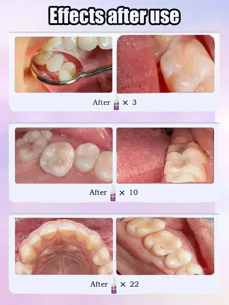 Ventas calientes Más vendido,  - Teeth Whitening Charcoal Powder reseña y precio