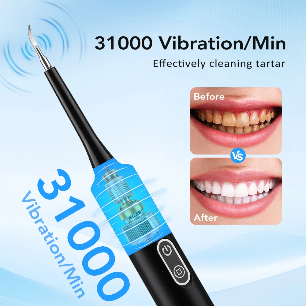 Limpiador Dental Eléctrico con - Teeth Whitening Toothbrush reseña y precio